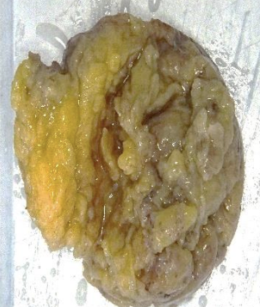 Description of the image